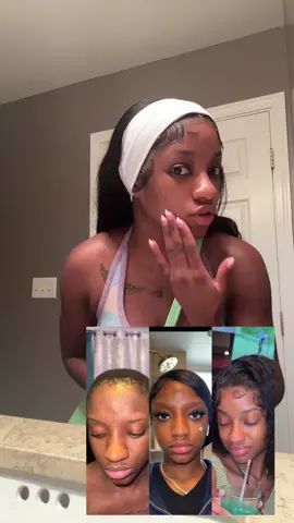 i promise it’s not that serious 🤣 get it or don’t but the proof is in the pudding. #fy #darkspots #darkspotcorrector #bleaching #carotone 