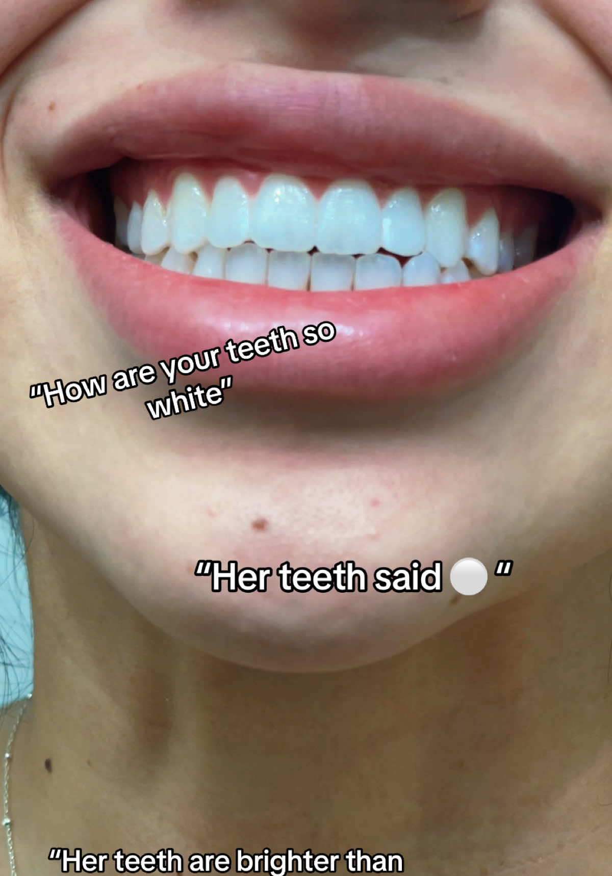 the biggest compliment!! 🦷✨ (no filter btw) #insanelybrightteethwhitening #teethwhitening #whiteteeth #teeth #dental 