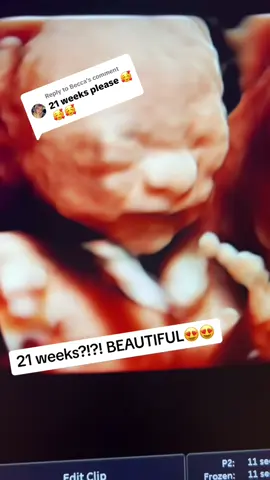 Replying to @Becca #21WeeksPregnant #PregnantSeeInc #5DULTRASOUND ##call703-209-2544