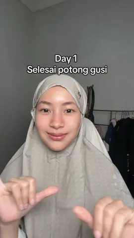 Update Day 1 setelah #potonggusi auto jadi cewe kalem, chubby, dan yg tida banyak bicara 🤗🤣 #gingivektomi  #behelstory #beheljourney #behelgigi 