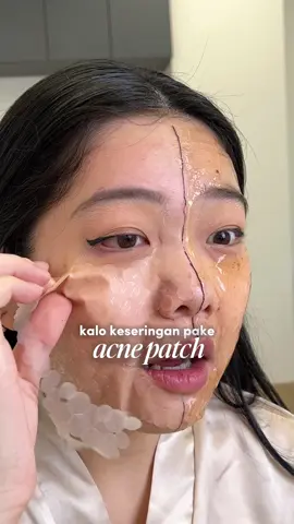 acne patch bikin BOPENG? 😱 #jerawat #maskerjerawat #foryou #trending #acne           
