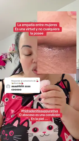 Respuesta a @🍒🐆Marie🐆🍒 uno da lo que recibe y tus comentarios Dios los recompensará  #tiktokshopblackfriday #tiktokshopcreatorpicks #zseasuperbrandday #tiktokshoplabordaysale #hidradenitissuppurativa @mymagichealer_usa  @MyMagicHealer 