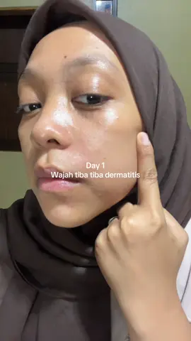 #dermatitis 
