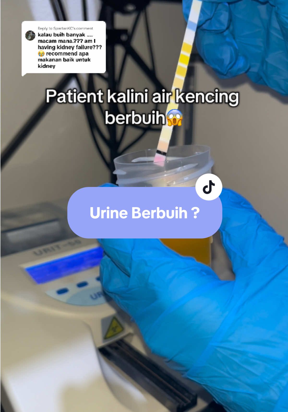 Replying to @SpartanKC  Sepatutnya protein tak patut ada dalam urine.. Kalau urine berbuih atau mengandungi protein berkemungkinan buah pinggang bocor😉 Dapatkan pemeriksaan segera‼️ 📍di Poliklinik Maya 24jam Pengkalan Chepa 📞 017-2002 247 #urine #fyp #fyppppppppppppppppppppppp #medical #klinik 