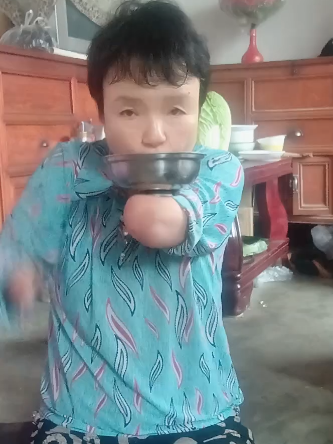 我是一个六零后的先天性残疾人一直单身，没有文化，感谢所有关注我的人。#amputee #amputeelife #withoutlimbs #limbless