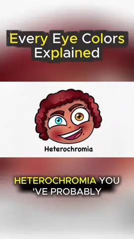 Heterochromia Eye Color #facefeature #eyecolor #heterochromia #knowledge #foryoupage 