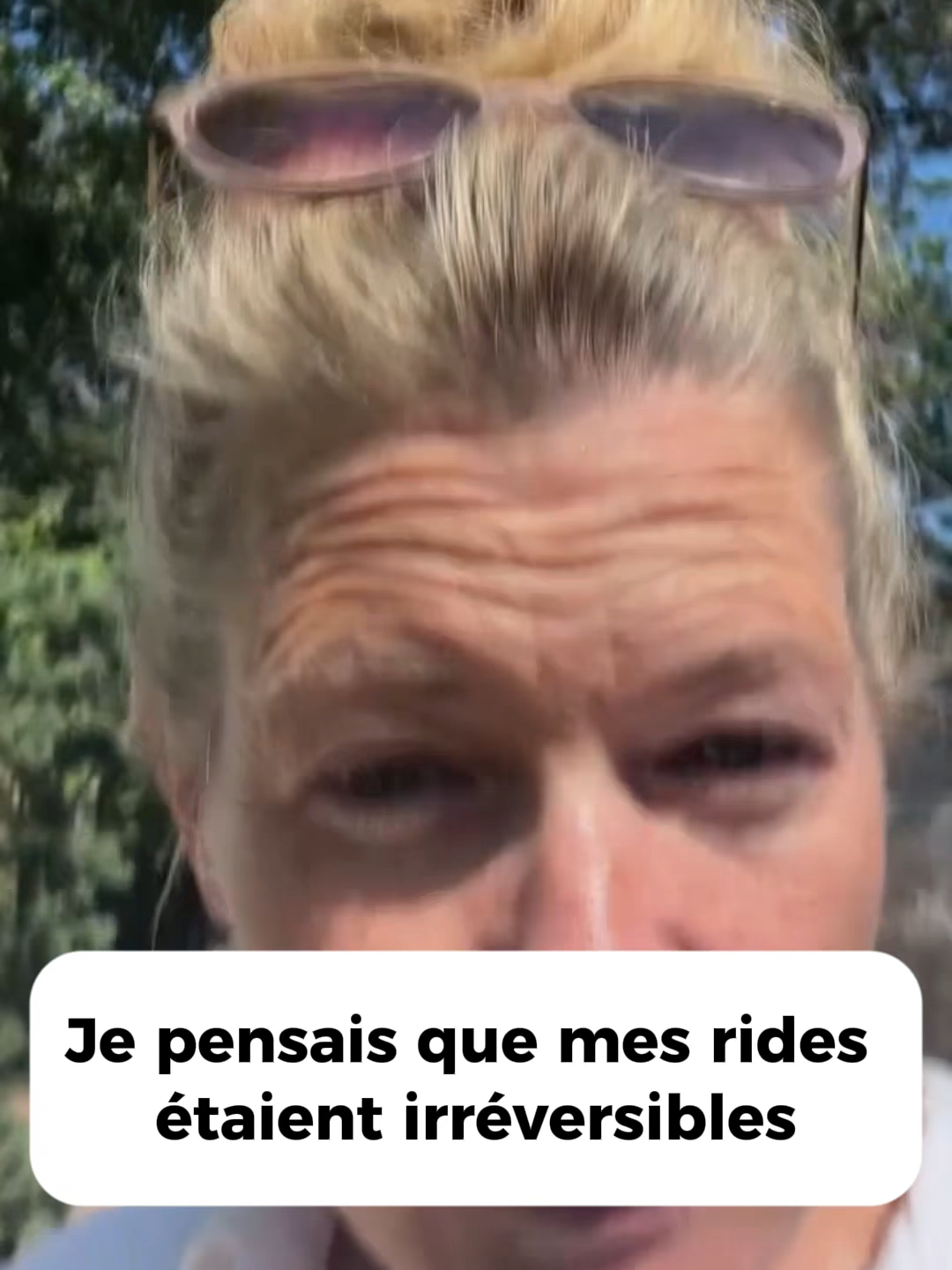 2 achétés = 1 offert + Livraison Offerte 👉 www.belury.com ✨ Le masque coréen qui a changé leur peau en une nuit  Stop aux sérums hors de prix et aux soins qui ne tiennent pas leurs promesses. Découvrez le soin de nuit qui a déjà transformé la peau de plus de 5 800 femmes françaises. Ce masque au curcuma et collagène agit pendant votre sommeil pour lisser, hydrater et repulper votre peau dès la première application. 💧 Hydrate intensément pendant 8 heures 👩‍🔬 Réduit visiblement ridules, tiraillements et zones sèches 🌿 Ingrédients doux & naturels, adaptés à toutes les peaux 🕓 Résultats visibles dès la première nuit : glow, fermeté, éclat ⭐️⭐️⭐️⭐️⭐️ Noté 4,8/5 par nos utilisatrices 👉 Essayez-le ce soir et observez la différence demain matin. #skincare #kbeauty #beauty #rides #collagen #facemask #beauté