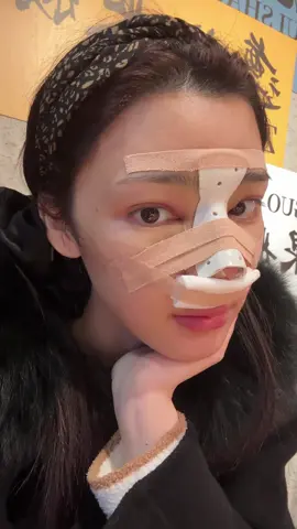 Become a beautiful girl #plastic #cosmetics #plasticsurgery #NoseJob 