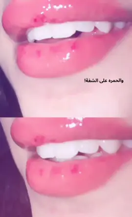 🥹❤..#كاضم_ساهر #والحمره_ع_الشفه 
