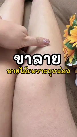 ขาลายหายได้เพราะถุงน่อง#ถุงน่อง #ถุงน่องขาเนียน #ถุงน่องกันแดด #ถุงน่องสีเนื้อ #khunluktarn 