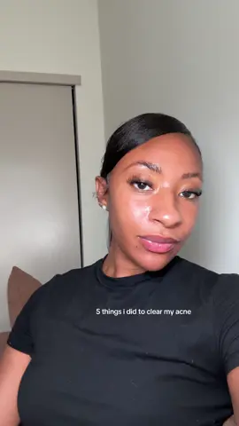 how i cleared my acne and hyperpigmentation. #acneproneskin #acneskincare #hormonalacne #fungalacne #largepores #hyperpigmentation #skincaretips #retinolskincare #skincaretreatment 