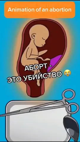 и грустно и смешно.. #портет#аборт#подпишись #поставьлайк #мдам #рекомендации #реки #летниекупальники #мандарин #синиевафли #хз #щп #какоенахуйщп #репосты #чекрепосты #какиенахуйрепосты 