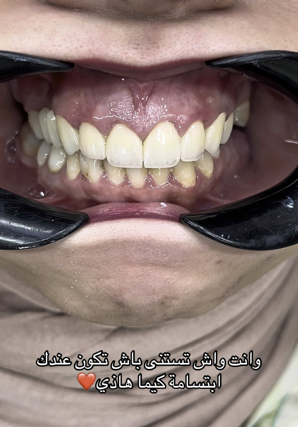 #algeria #pr #pourtoi #الشعب_الصيني_ماله_حل😂✌️ #الجزائر🇩🇿😘تيك_توك_ #algerie🇩🇿_maroc🇲🇦_tunisie🇹🇳 #viral #tiktok #viraltiktok #viralvideos 