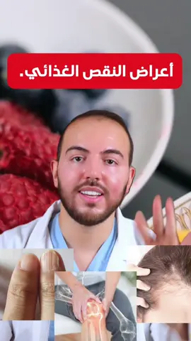 أعراض نقص الفيتامينات و المعادن. 🍱 🍋‍🟩 🍇  #fyp #explore #explorepage #maroc #nutrition 