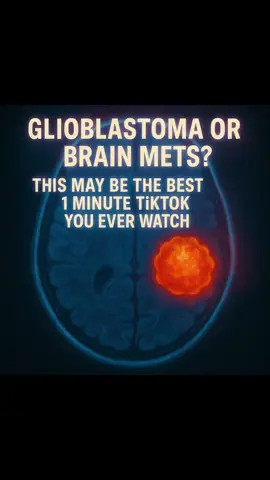 Prof Vogl in Frankfurt uses a groundbreaking treatment called TACP (Trans-Arterial Chemotherapy Perfusion) to target brain metastases and glioblastoma. Unlike standard IV chemo or tablets in the UK, which circulate through the whole body at relatively low levels, TACP delivers chemotherapy directly into the arteries feeding the tumour, where concentrations can be up to 100 times higher at the tumour site. This focused delivery means the cancer cells are hit harder while the rest of the body is spared much of the toxicity. Please do your own research and consider using an integrative approach alongside any treatment. I believe that is why I had such miraculous results with my own late stage 4 breast cancer, combining Prof Vogl’s advanced therapies, which are far ahead of UK options, with a broad integrative plan. Anyone can self refer to Prof Vogl. There is a bit of a language barrier, but I can help if needed. Never use booking agencies, they charge far more and take payment upfront, whereas Prof Vogl charges on the day, around €3,900. This covers everything: MRI and CT scans (more advanced than UK ones), the treatment itself, consultation, medication, and a hospital bed, all as a same day case. For those wanting personal one to one input, I also offer a bespoke referral letter for quick response from Prof Vogl, support managing the process, and an experience based non medical consultation. This carries a small fee to cover my time, as I am still in recovery, living with lasting side effects, and raising six children, but I want to help as many people as I can, and I am honoured to do so. My email is lauralucy1972@gmail.com Hashtags: #Glioblastoma #TACP #BrainMets #IntegrativeOncology #fyp