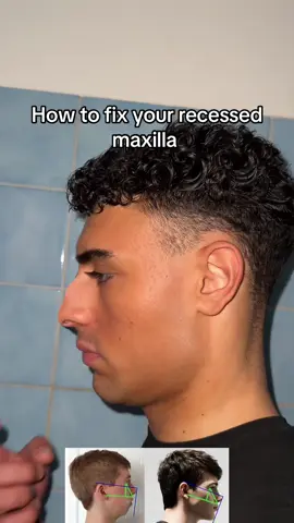 Try @Umax App to fix your maxilla #SelfImprovement #fyp #gabrieldridi 