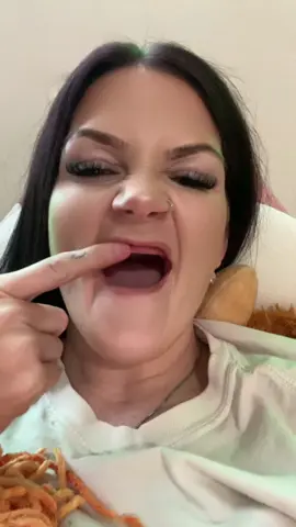 Everyone loves a toothless baddie #dentures #denture #denturesmile #denturesatayoungage #toothless #viral 