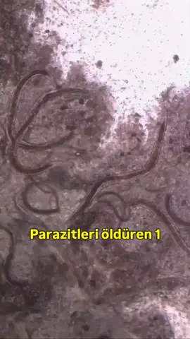 👇🏼Karanfil Çayı Nasıl Yapılır?👇🏼 ⬇️Malzemeler:⬇️ 1 su bardağı su 5-6 adet karanfil 1 dilim limon (isteğe bağlı) 🗨️Nasıl Yapılır?🗨️ * Suyu kaynatın. * Suyu bir bardağa yada demliğe aktarın ve içine karanfil tanelerini bırakın. * Üzerini kapatıp 30 dakika kadar demlenmesini bekleyin. * Ardından karanfilleri çayın içinden çıkarın. * Dilerseniz sade bir şekilde, dilerseniz içine limon dilimi, çubuk tarçın, bal gibi tatlandırıcılar ilave ederek servis edin. ------------------------------------------------------------------ Parazitlerden kurtulmak için kullanılan birçok doğal yöntem var. Sarımsak, kabak çekirdeği, hatta Hindistan cevizi yağı… Evet, hepsi faydalı, ama çoğu insan çok önemli bir detayı gözden kaçırıyor: Bu besinler parazitlerin yumurtalarını yok edemez. İşte bu yüzden çoğu antiparazit tedavisi başarısız olur. Birkaç gün kendinizi iyi hissedersiniz, ama kısa süre sonra belirtiler geri döner. Çünkü yumurtalar çatlayarak yeni parazitlere dönüşür ve döngü tekrar başlar. Ancak bu döngüyü kıran tek bir besin var: Karanfil! Karanfil, doğadaki en güçlü antiparazit baharat olarak bilinir. İçeriğinde bulunan öjenol adlı etkili bileşik, parazit yumurtalarının sert kabuklarını delerek içine girer ve yumurtalar çatlamadan onları yok eder. Böylece yalnızca parazitleri değil, aynı zamanda üreme döngülerini de engeller. Karanfil, yüzyıllardır bağırsak solucanları, mantar enfeksiyonları, cilt problemleri ve parazitlerin salgıladığı toksinlere karşı kullanılmıştır. Düzenli olarak tüketildiğinde, bağışıklığı güçlendirir, sindirim sistemini destekler ve vücudu zararlı mikroorganizmalardan temizler. Sağlıklı bir yaşam için sofralarınızda mutlaka yer vermeniz gereken güçlü bir şifa kaynağıdır. . #karanfil #sağlık #parazitlerdenkurtul #doğalçözüm #antiparazit 