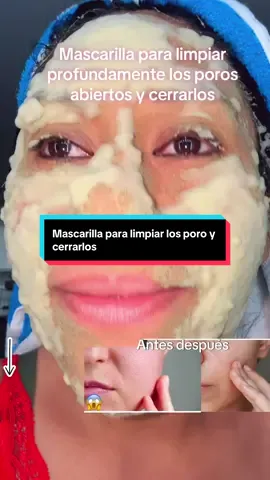 #hollibasil #bubblemask #bubbledeepmask #anitaceto #paralimpiarlosporos 