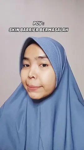 Rawat Skin Barrier Yang Bermasalah Dengan Chalonese day cream dan night cream ya. Bikin kulit lebih lembab, halus dan menyamarkan keriput #chalonese #chalonesemoisturizer  #moisturizergel  . . . . #modalkontendoang  #satukontentiaphari 