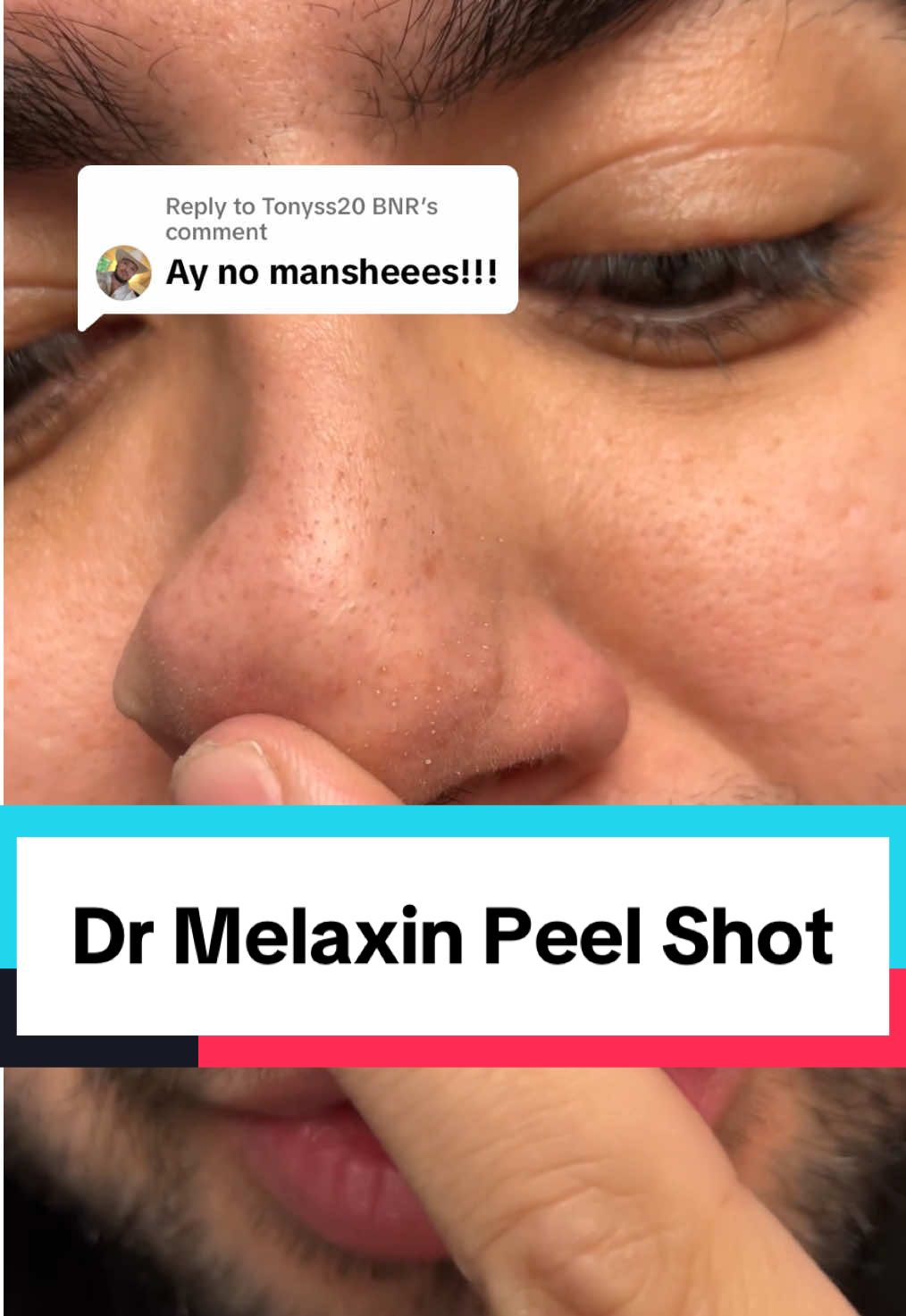 Replying to @Tonyss20 BNR Dr Melaxin Peel Shot👌 #drmelaxinpeelshot #tiktokshopcreatorpicks 