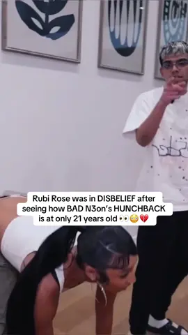 Rubi Rose was in DISBELIEF after seeing how BAD N3on’s HUNCHBACK is at only 21 years old 👀😳💔 | #n3on #rubirose 