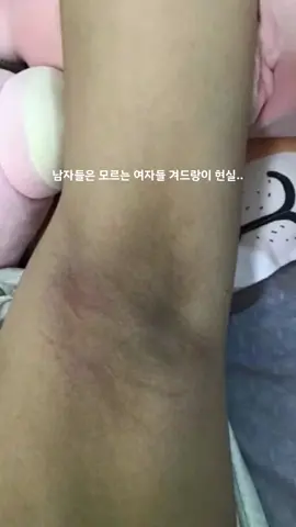 친구야.. 덕분에 나도 나시 입고 손들 수 있게 됐다,,,ㅠㅠ 나랑 같은 고민 가지고 있으면 틱메로 <겨드랑이> 보내바 꿀템 알려주께!!  #추천 #추천떠라 #겨드랑이 #겨드랑이착색 