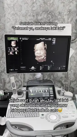 #fyp #vidioviral #usg #babyboy #story 