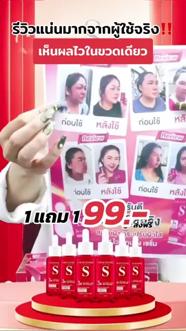 รีวิวแน่นมากจากผู้ใช้จริง‼️ ##เอสเซรั่ม##เอสไวท์เทนนิ่งเซรั่ม##สบู่##สบู่เอส##สบู่เอสโพรเฟคโซฟ##ส่งฟรี##ฟีดดดシ##กระเเสมาเเรง##เทรนด์วันนี้##ใช้ดีบอกต่อ##ต้องลองๆ##fyp##ดังมากในtiktok##ติ๊กต๊อก##ดังมากในtiktokตอนนี้##ฮิตในtiktok##เปิดการมองเห็น##สกินแคร์##หน้าใส##ที่สุดแห่งปี