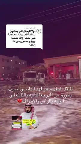 الرد على @…  المنقذ البطل ماهر فهد الدلبحي اصيب بحروق من الدرجه الثانيه والثالثه في الوجه والرأس والأطراف💔#fy #fyp #الدوادمي #foryou #