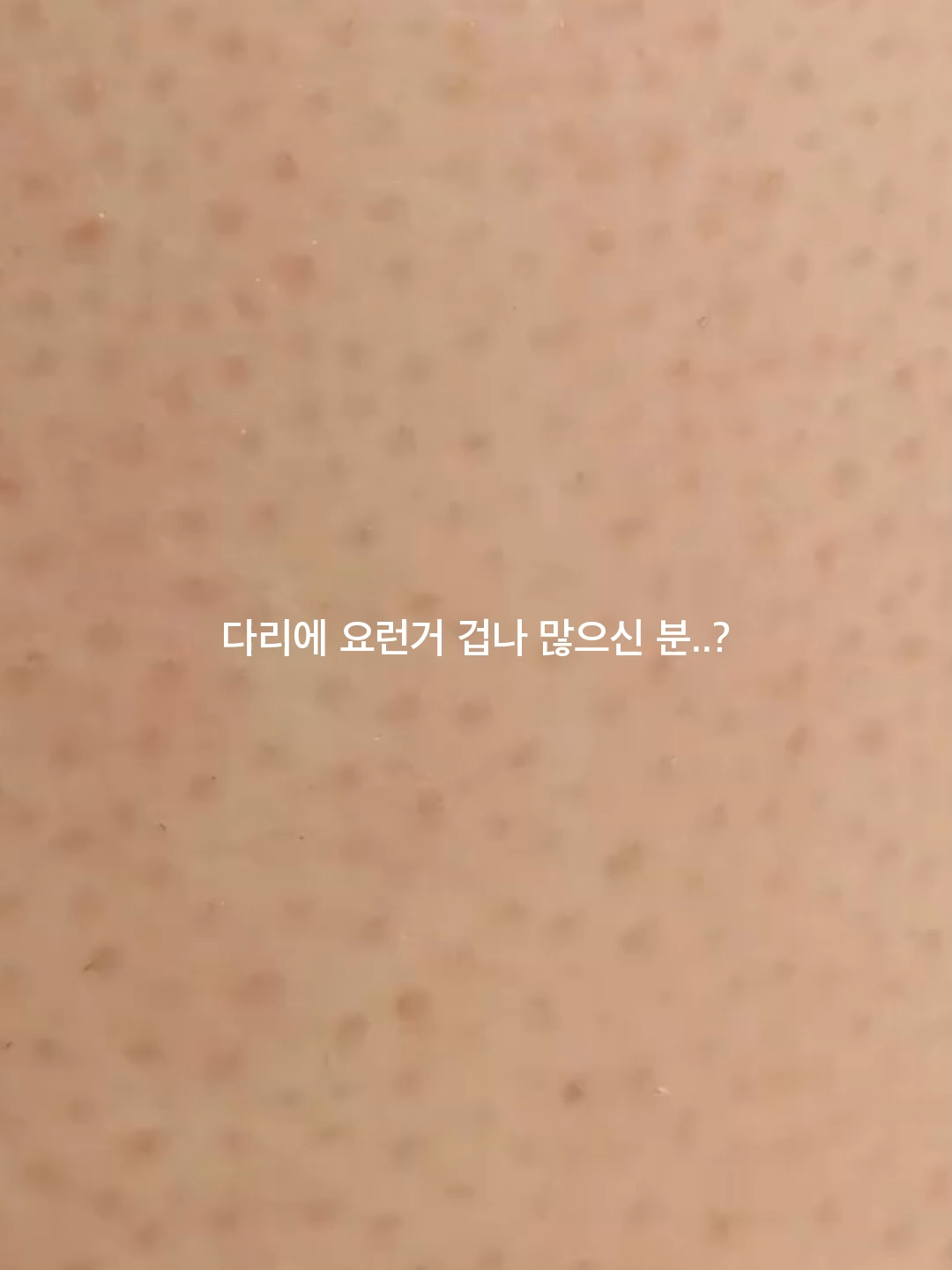 다리 알갱이 때문에 이것저것 해봤는데.. 샵에서 알려준 대로 써보니까 진짜 빨리 줄었음.  요즘 품절 잦아서 미리 검색해두는 게 나음. 댓글에 