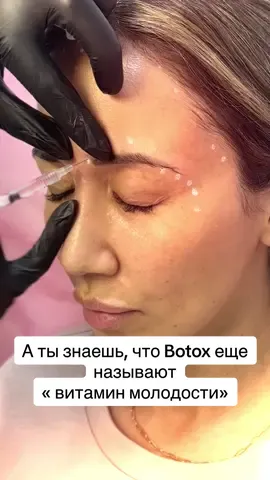 #BotoxFullFace #БотоксЛицо #Ботокс #BotoxBeforeAfter #БотоксДоПосле  