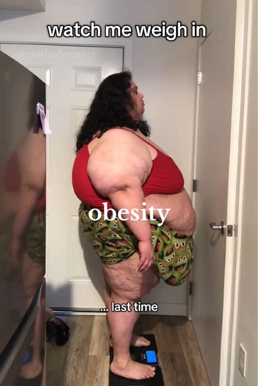 if i would have put myself and my health first then, i wouldn’t be here right now, in this position. let this be an example. your life matters.  📹🤳🏽📆: (02/03/2024) #fyp #health #obesity #viral #xyzbca 