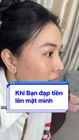 Thay đổi nhan sắc với kĩ thuật tiêm nâng cơ đa tầng kết hợp tăng sinh#bap #bapprofhilo #tiemmoi @VIỆN THẨM MỸ CHIANG MIE #nângco #giamchayse 