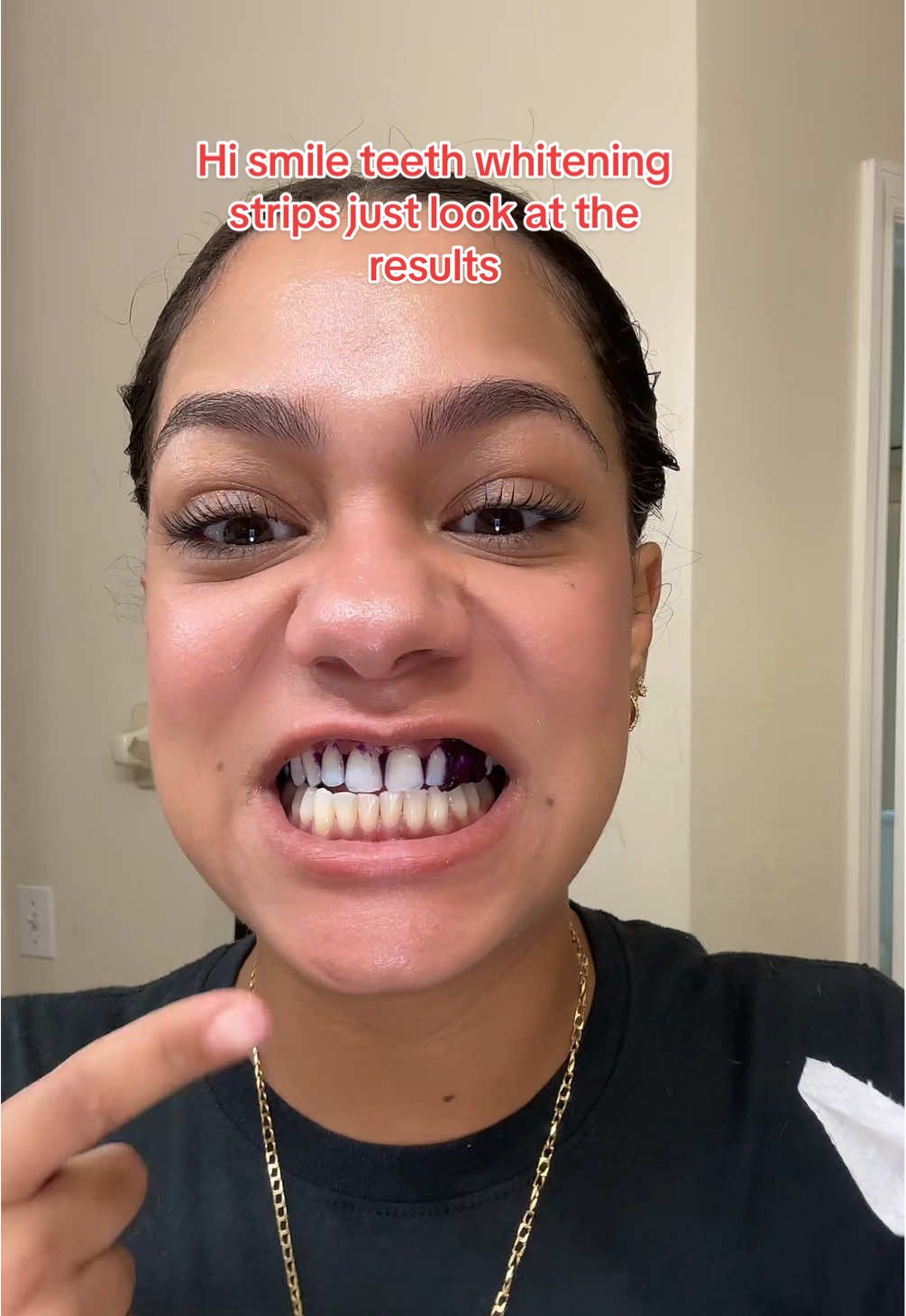 Hismile purple teeth whitening strips helps cancel out the yellow in your teeth in just 30 mins no peroxide #hismile #teethstrips #teethwhitening #trending #fyp 