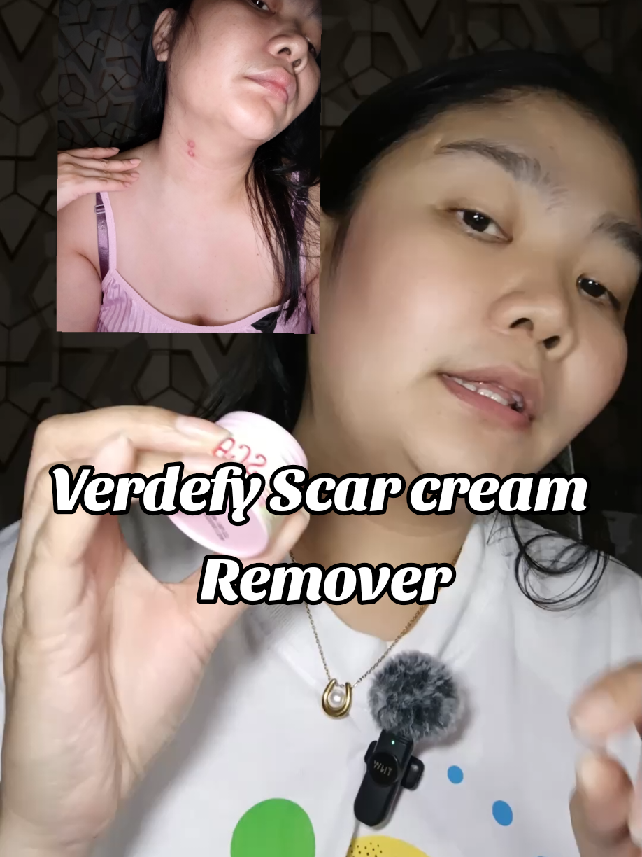 Verdefy Scar cream Remover perfect sa may mga peklat✨ @verdefyph.official  #scarcream  #peklatcream  #verdefyscarremovercream  #verdefy  #scar 