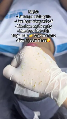 #trimun #mụn #trịmụn #mụnlung #chamsocdamat #thaydoi #xuhuong #làmđẹp 