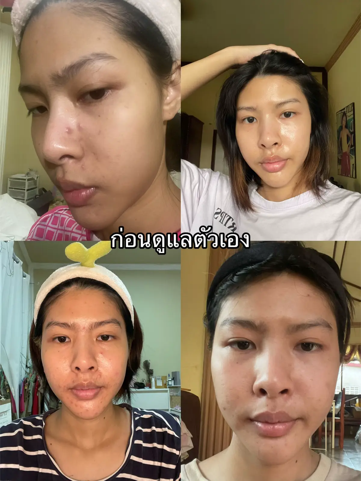 เอาเรื่องอยู่นะ 💖✨ #ดูแลตัวเอง #พัฒนาตัวเอง #ทริคดูแลผิว #ทริคดูแลตัวเอง #เปลี่บนแปลงตัวเอง 