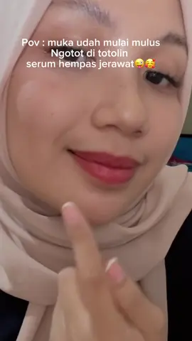 Dulu insecure gara-gara jerawat, sekarang lebih pede bareng Icelerskin 💕 #serumtotoljerawat #icelerskin #acnetreatment #serumjerawat #obatjerawat   