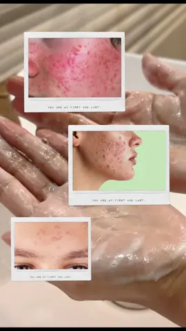 Zenova facewash by@SkinEra Life Sciences is a very good facewash whenever u start using skincare products just be consistent with your routine and at least give 2-3 mnths to a product before judging and changing  #skincareroutine #facewash #fypシ #viral 