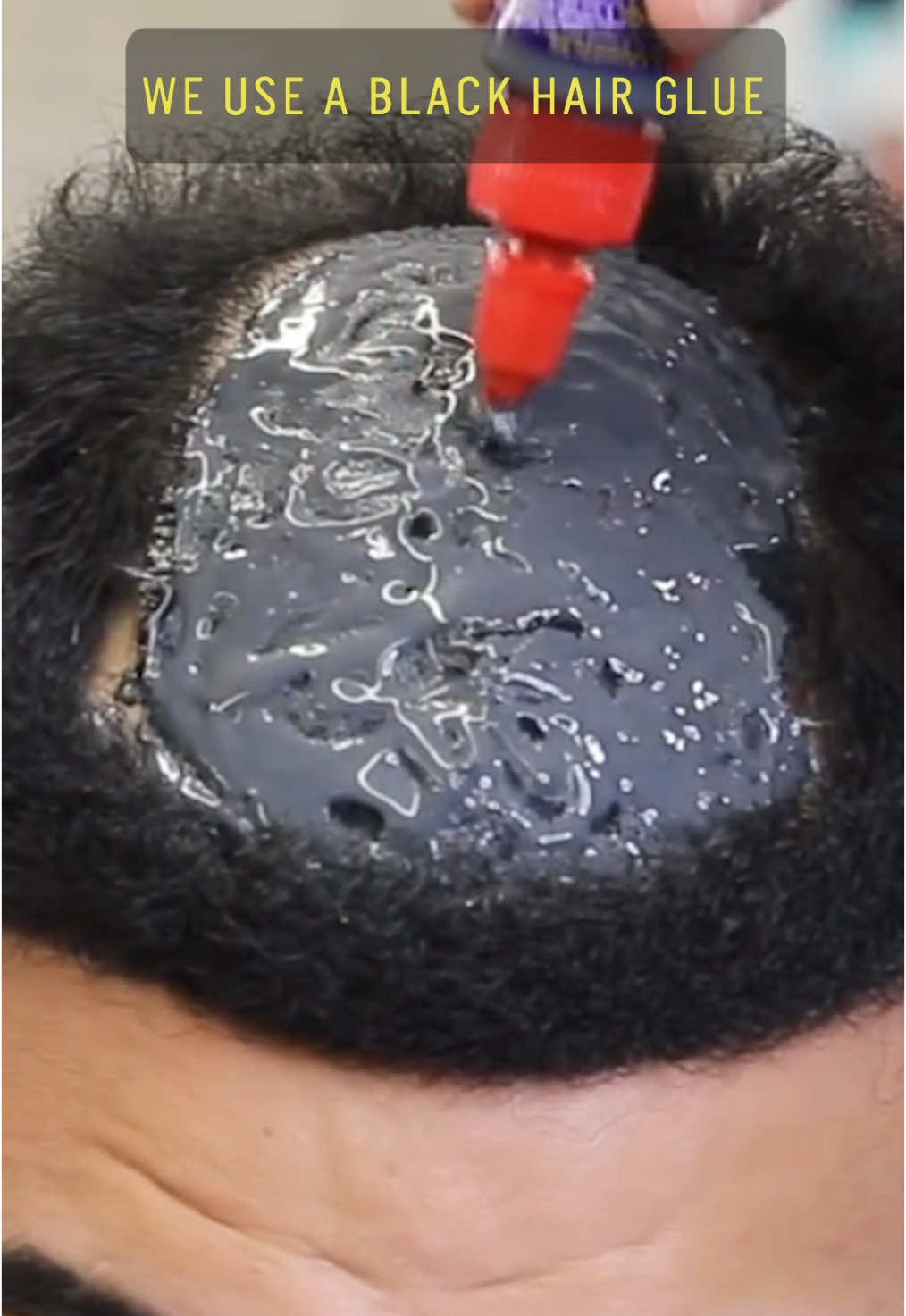 Adrin the Barber @adrinthebarberr brings bald heads back to life. His man weaves erase hairlines and fill bald spots using pro adhesives—for results that last up to 2 months. Watch the confidence snap back. #HairReplacement #BarberLife #MensGrooming #HairTransformation
