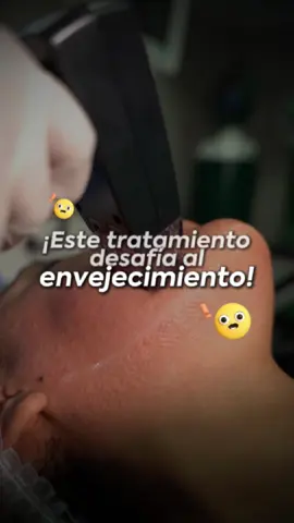 ¿Tienes la piel con flacidez y sin firmeza?  Descubre Morpheus8, la tecnología que desafía al envejecimiento. ✨ Resultados naturales, seguros y visibles desde la primera sesión. 💎 📍 En Elebelle cuidamos tu piel con innovación. #morpheus8 #bellezanatural #peru #elebelle #liftingfacial 