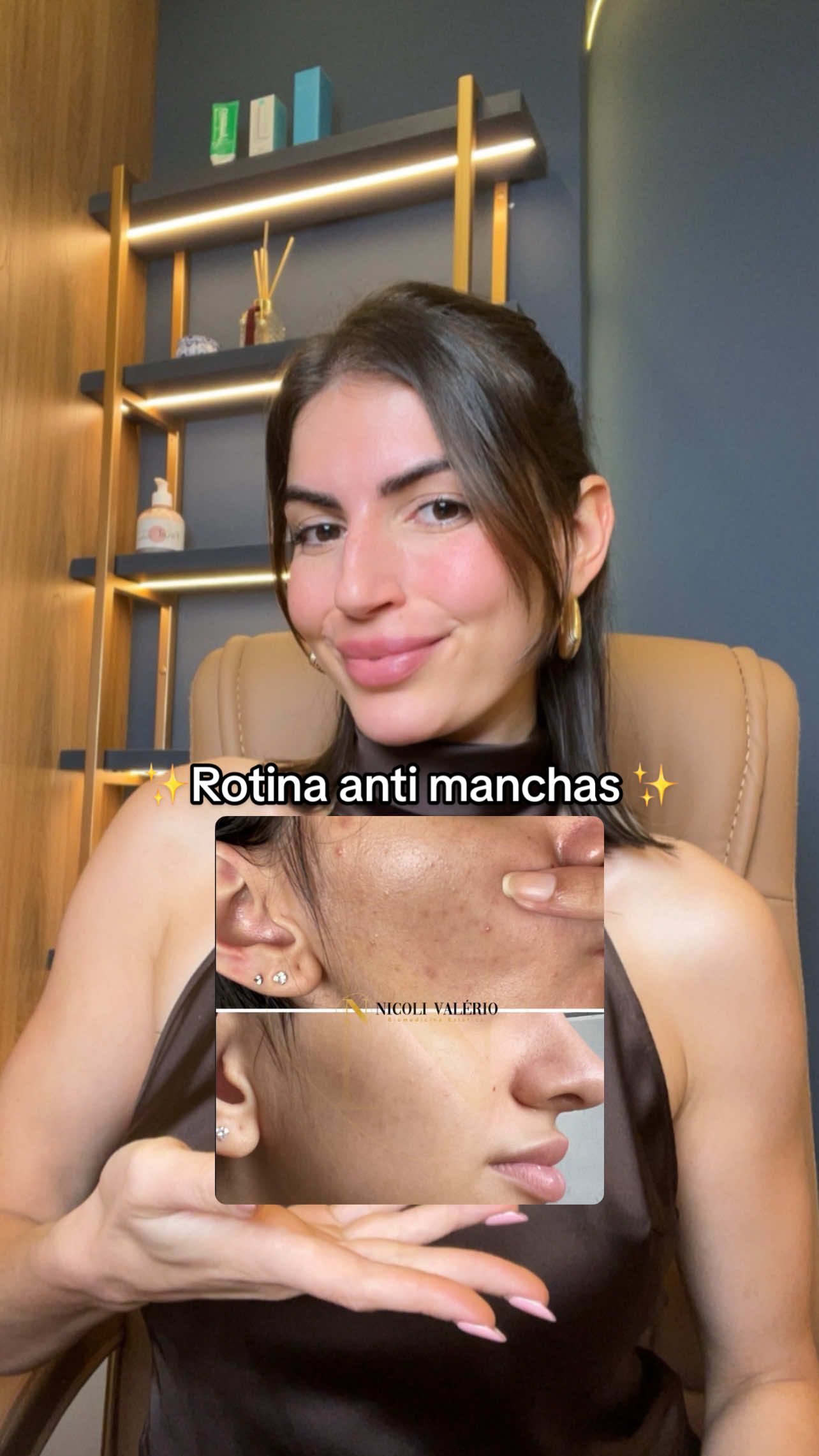 Rotina anti manchas pós acne atualizada ✨✅