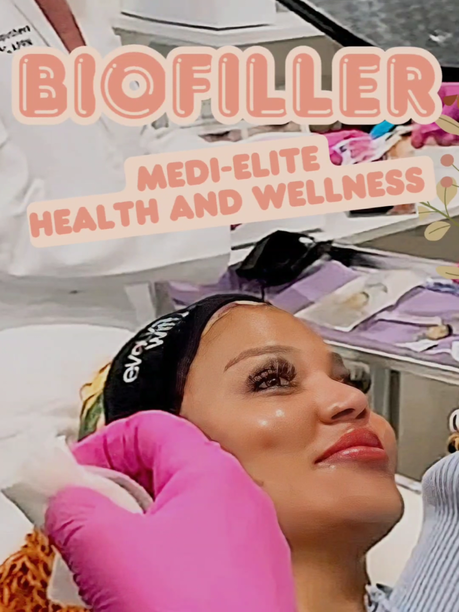 Luxury lifestyle = luxury skincare ✨ @Medi Elite Health and Wellness biofillers are my secret weapon.  #skincare #skincaretips #SkinCare101 #fyp #dallas 