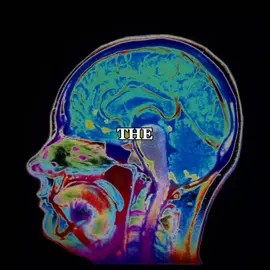 how childhood events affects the brain's development and the rise of psychological disorders #brainfacts #brainscience #neuroscience #darkpsychology #childhoodtrauma 