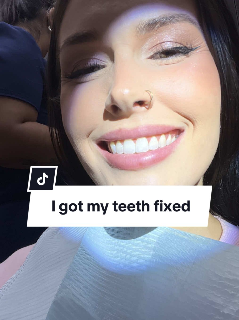 I’m so excited to finally have the smile I’ve always wanted 😭💖  #teeth #smile #newsmile #compositebonding #fyp 