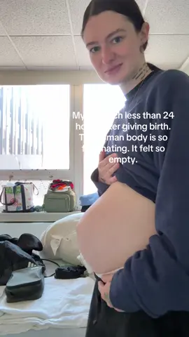 Less than 24 hours after giving birth. Weirdest feeling in the world!! It only lasted a few days but it was so fascinating to watch my body change so quickly!! #postpartum #fyp #MomsofTikTok 