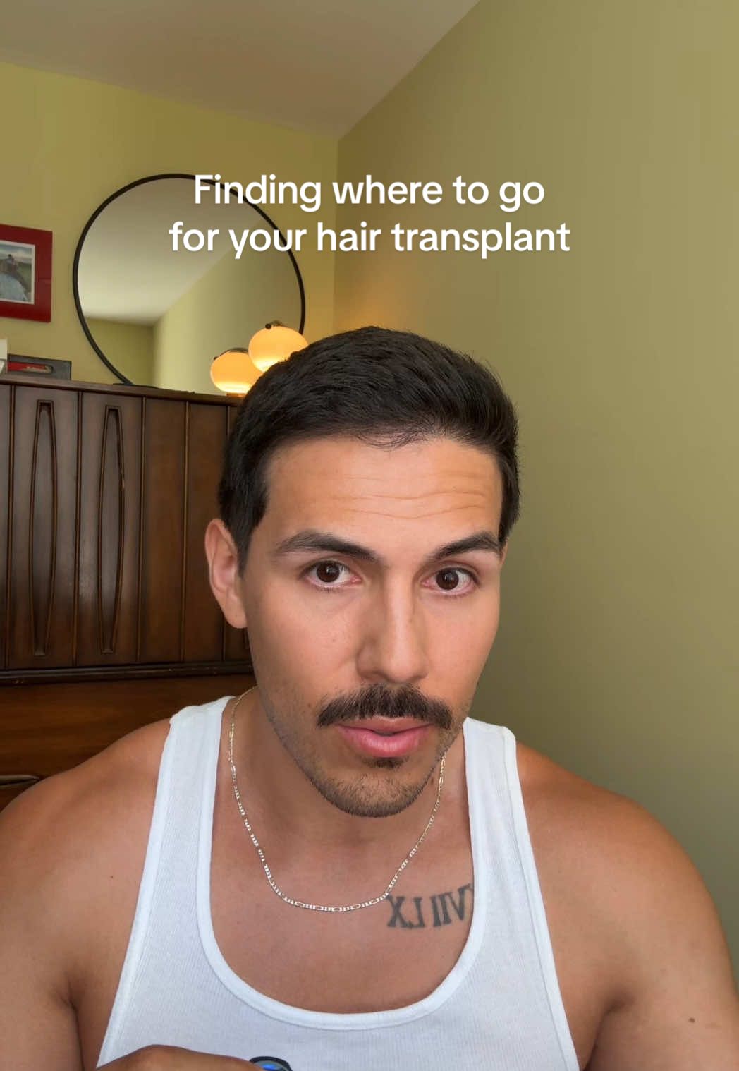 Finding where to go to get your hair transplant is tough so lemme help ya 🤝 #hairtransplant #balding #malepatternbaldness #hairjourney #bald #hairloss #hairtransformation 