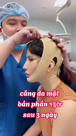 căng da bán phần 15tr sau 3 ngày nhé mn! 