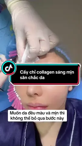 Cấy chỉ collagen sáng mịn - săn chắc da#xuhuong #xuhuongtiktok2023 #tuongtac #tuongtac_xuhuong #caychicollageng 